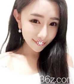 朱曉東給我做自體脂肪填充額頭太陽穴淚溝前，我也想知道貴陽美貝爾誰去過啊