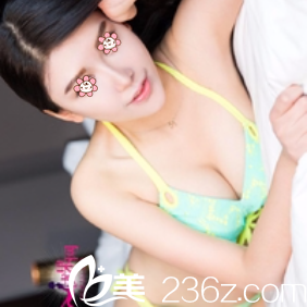 權(quán)衡很多，我去了韓國(guó)POINT整形外科院長(zhǎng)樸南錫那兒做了曼托假體胸。