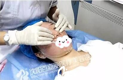 微針祛痘術(shù)后敷面膜 微針祛痘術(shù)后敷面膜