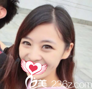 沒有在合肥福華整形做鼻子整形前的照片 沒有在合肥福華整形做鼻子整形前的照片