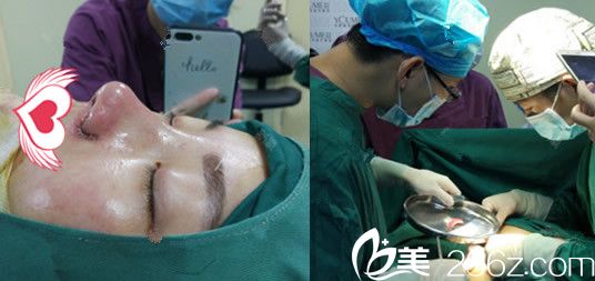 趙章杰綜合隆鼻手術(shù)過程中 趙章杰綜合隆鼻手術(shù)過程中