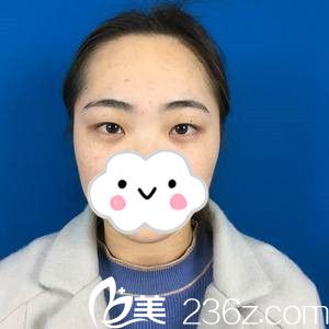 手術(shù)前的我 手術(shù)前的我