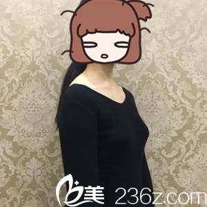 手術(shù)前的我 手術(shù)前的我