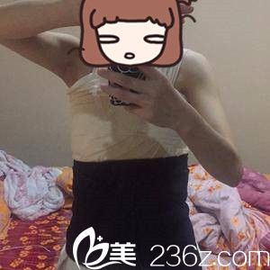 手術(shù)后第三天 手術(shù)后第三天