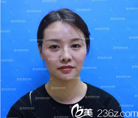 來深圳美加美整形醫(yī)院整形術(shù)前 來深圳美加美整形醫(yī)院整形術(shù)前