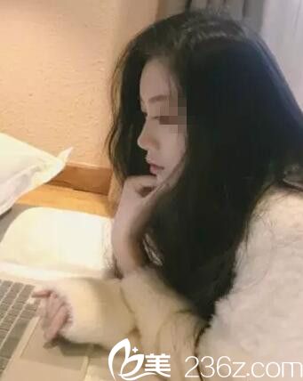 源<!--<i data=20240703-sp></i>-->萍做鼻綜合術(shù)后17天案例 源<!--<i data=20240703-sp></i>-->萍做鼻綜合術(shù)后17天案例