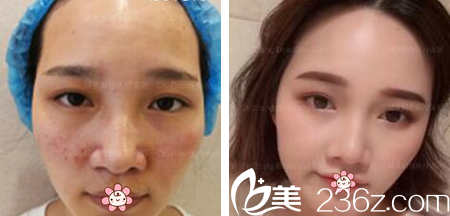 央金主任光電美膚案例