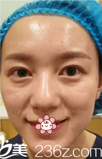 術(shù)前的我 術(shù)前的我