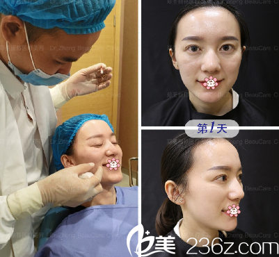 周業(yè)松院長給我做的手術(shù) 周業(yè)松院長給我做的手術(shù)