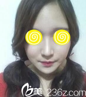 找海南韓美整形美容醫(yī)院彭鑫做鼻整形的同時拿了一份2018全新整形價格表