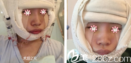 鄭宰學(xué)院長剛給我做完手術(shù)沒幾天 鄭宰學(xué)院長剛給我做完手術(shù)沒幾天