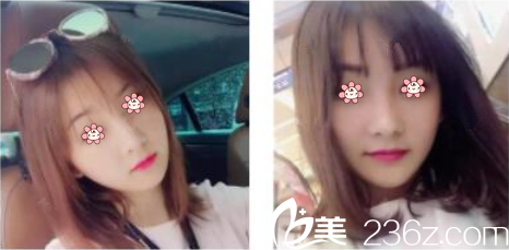 林鐘學(xué)院長給我注射完一周