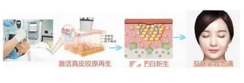 全新式熱瑪吉優(yōu)勢
