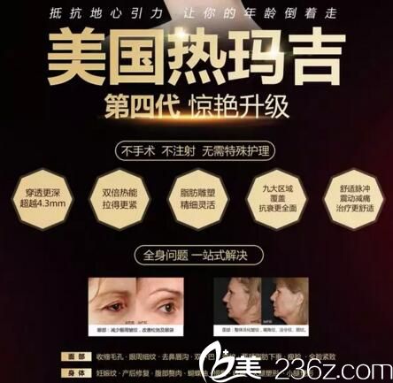 長沙亞韓美國第四代熱瑪吉經(jīng)驗(yàn)升級