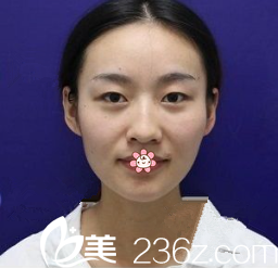 我的術(shù)前照 我的術(shù)前照