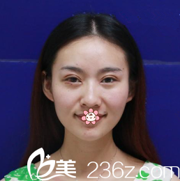 文晶煥院長給我術(shù)后第四天 文晶煥院長給我術(shù)后第四天