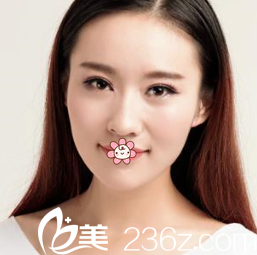 文晶煥雙眼皮術(shù)后半個月 文晶煥雙眼皮術(shù)后半個月