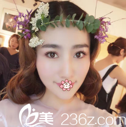 我舍友找韓國(guó)IRIS整形外科文晶煥割的韓式雙眼皮效果讓我心動(dòng)還行動(dòng)了。