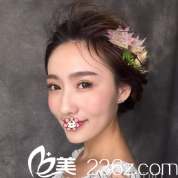 韓國IRIS整形外科文晶煥雙眼皮術(shù)后40天效果 韓國IRIS整形外科文晶煥雙眼皮術(shù)后40天效果