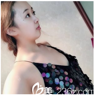 東莞美立方整形醫(yī)院李志剛院長隆胸案例術前 東莞美立方整形醫(yī)院李志剛院長隆胸案例術前