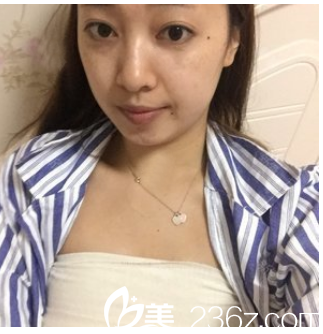 剛做完自體脂肪隆胸在醫(yī)院的自拍 剛做完自體脂肪隆胸在醫(yī)院的自拍