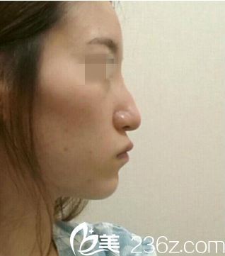 手術(shù)當(dāng)天的我 手術(shù)當(dāng)天的我