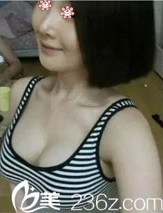 沒在貴陽美貝爾那兒做妙桃琴面圓形假體胸之前我當(dāng)然也自卑啊。