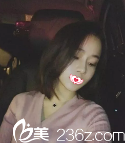 很慶幸自己找衡水天宏東主任做鼻綜合整形 術(shù)后只用22天就讓我擁有精致小巧鼻