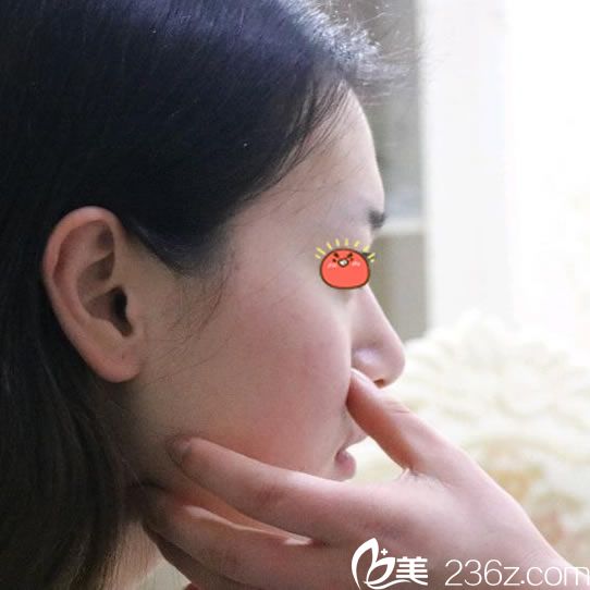 時光美極康樹勇院長面診過程 時光美極康樹勇院長面診過程