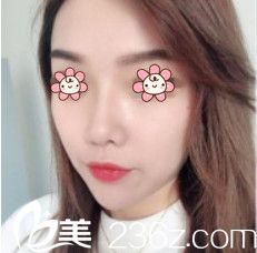 術(shù)后兩個(gè)月效果