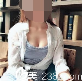 韓國(guó)PJS整形外科樸真奭自體脂肪豐胸術(shù)后三個(gè)月 韓國(guó)PJS整形外科樸真奭自體脂肪豐胸術(shù)后三個(gè)月