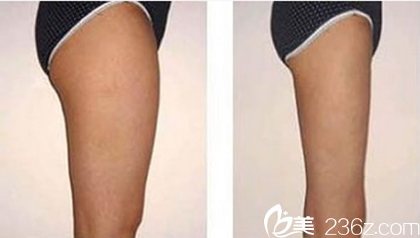 韓國美爾韓整形美體塑形