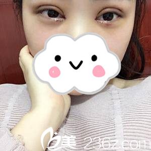 術(shù)后第二天 術(shù)后第二天