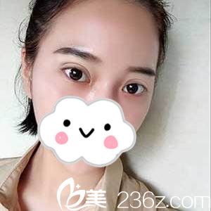 手術(shù)后第九天 手術(shù)后第九天