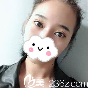 術(shù)后第18天 術(shù)后第18天