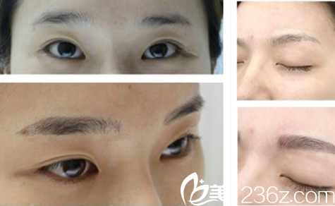 擅長半的路阿藍醫(yī)生案例對比圖 擅長半的路阿藍醫(yī)生案例對比圖