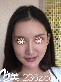 術(shù)前老氣的我 術(shù)前老氣的我