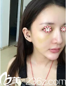 <!--<i data=20240703-sp></i>-->院長給我做完手術(shù)第五天 <!--<i data=20240703-sp></i>-->院長給我做完手術(shù)第五天