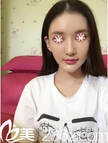 術(shù)后半個(gè)月 術(shù)后半個(gè)月