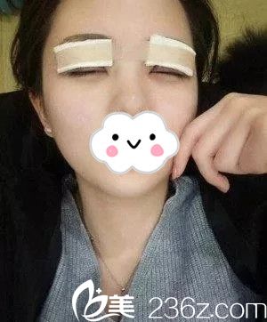 術(shù)后1天 術(shù)后1天