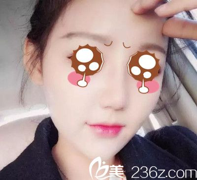 孫承用院長鼻綜合手術(shù)案例