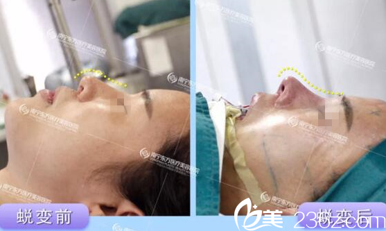 在南寧東方做鼻修復(fù)手術(shù)當(dāng)天 在南寧東方做鼻修復(fù)手術(shù)當(dāng)天