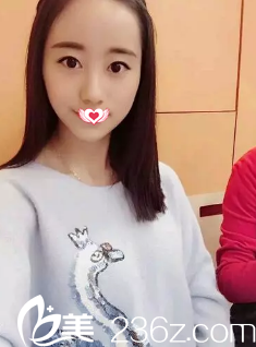 術(shù)前內(nèi)雙眼皮 術(shù)前內(nèi)雙眼皮