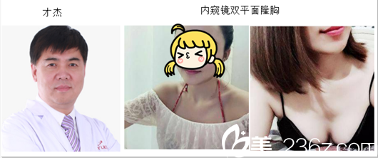 北京美萊才杰及其內(nèi)窺鏡雙平面隆胸 北京美萊才杰及其內(nèi)窺鏡雙平面隆胸