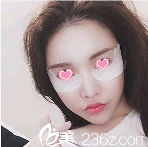 黃杰面部脂肪填充案例第13天效果 黃杰面部脂肪填充案例第13天效果