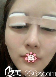 手術(shù)當(dāng)天 手術(shù)當(dāng)天