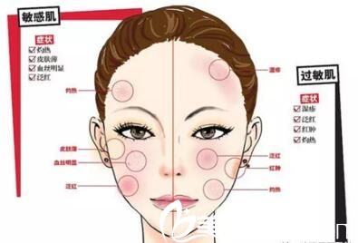 元辰小氣泡可以解決多種毛孔肌膚問題