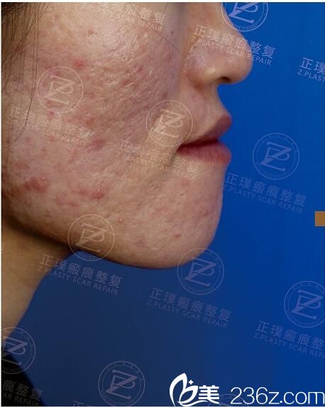 術(shù)前照片 術(shù)前照片