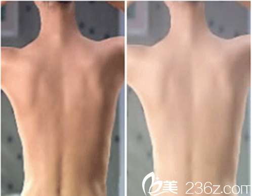 韓國延世SK整形醫(yī)院注射案例對比效果 韓國延世SK整形醫(yī)院注射案例對比效果