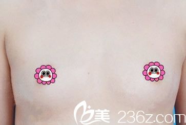 蘭州亞韓整形醫(yī)院自體脂肪隆胸前 蘭州亞韓整形醫(yī)院自體脂肪隆胸前